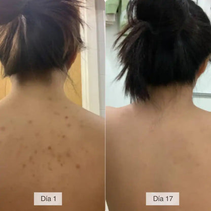 Toalla Exfoliante Anti Bacterias ZenBodis™